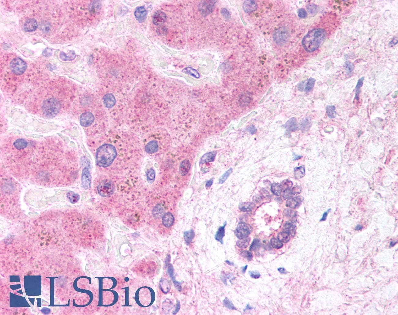 IHC-plus™ Polyclonal Goat anti-Human LRP6 Antibody (aa1547-1560, IHC)