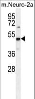 IHC-plus™ PRMT1 Antibody (aa317-346)