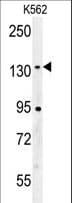 CILP2 Antibody (aa825-852)
