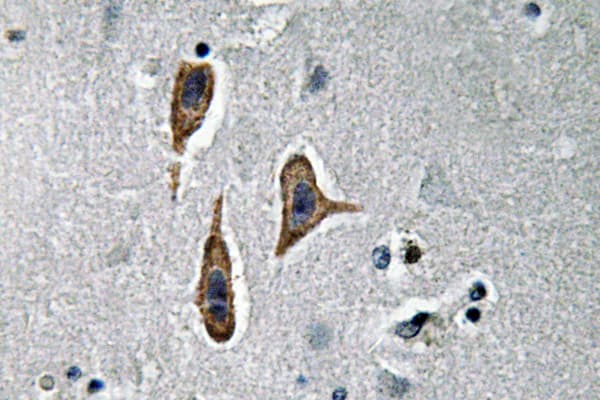 NPHS1 / Nephrin Antibody (His892)