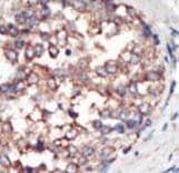PIK3CG / PI3K Gamma Antibody (aa1074-1102)