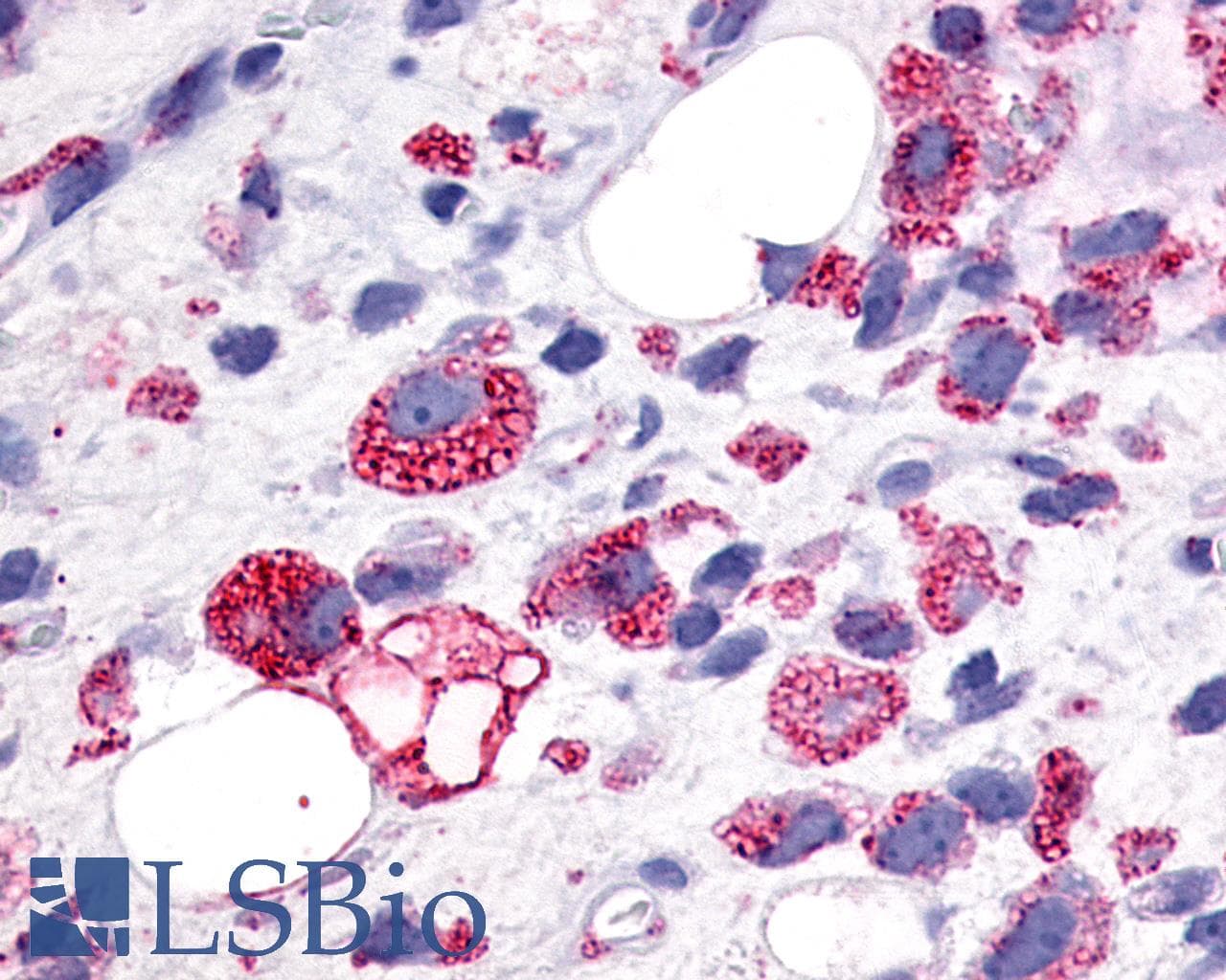 PathPlus™ GPR34 Antibody (C-Terminus)