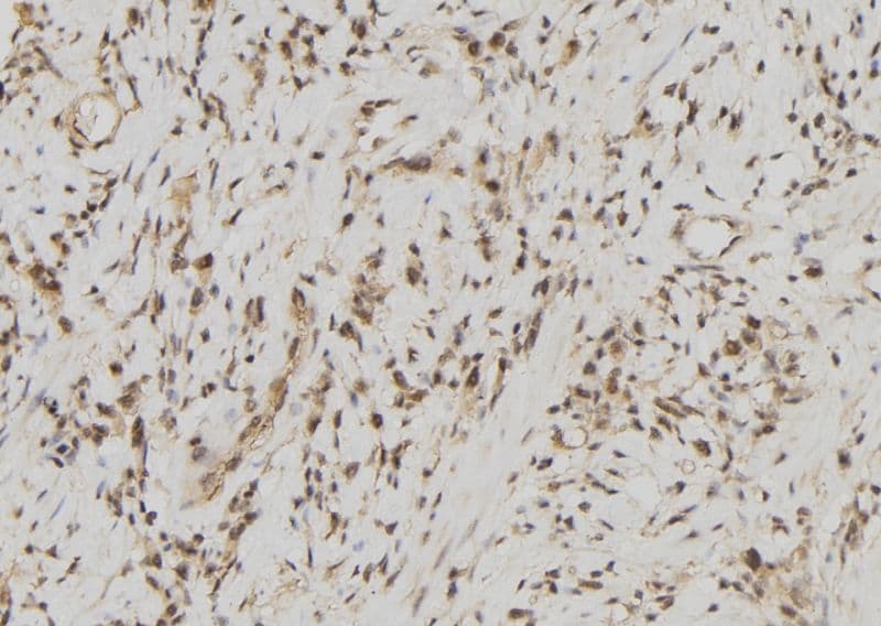 FDPS Antibody