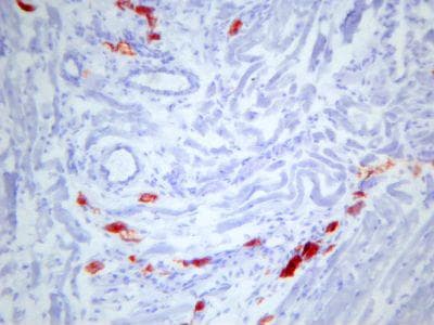 c-Kit / CD117 Antibody (clone ACK4)