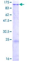 Human MAN2B2 Protein (Recombinant GST)