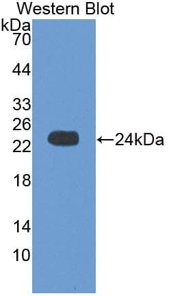 CRYAB / Alpha B Crystallin Antibody (aa1-175, Biotin)