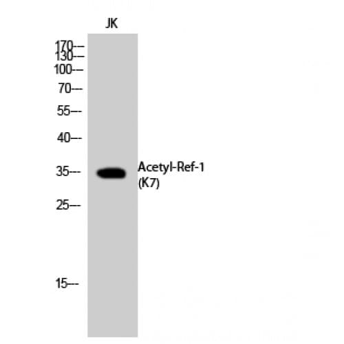 APEX1 / APE1 Antibody (acetylation site of K7.)
