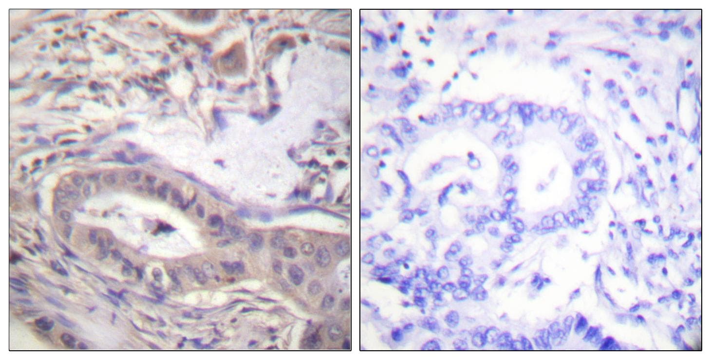 BCL2L1 / BCL-XL Antibody (phospho-Thr47)