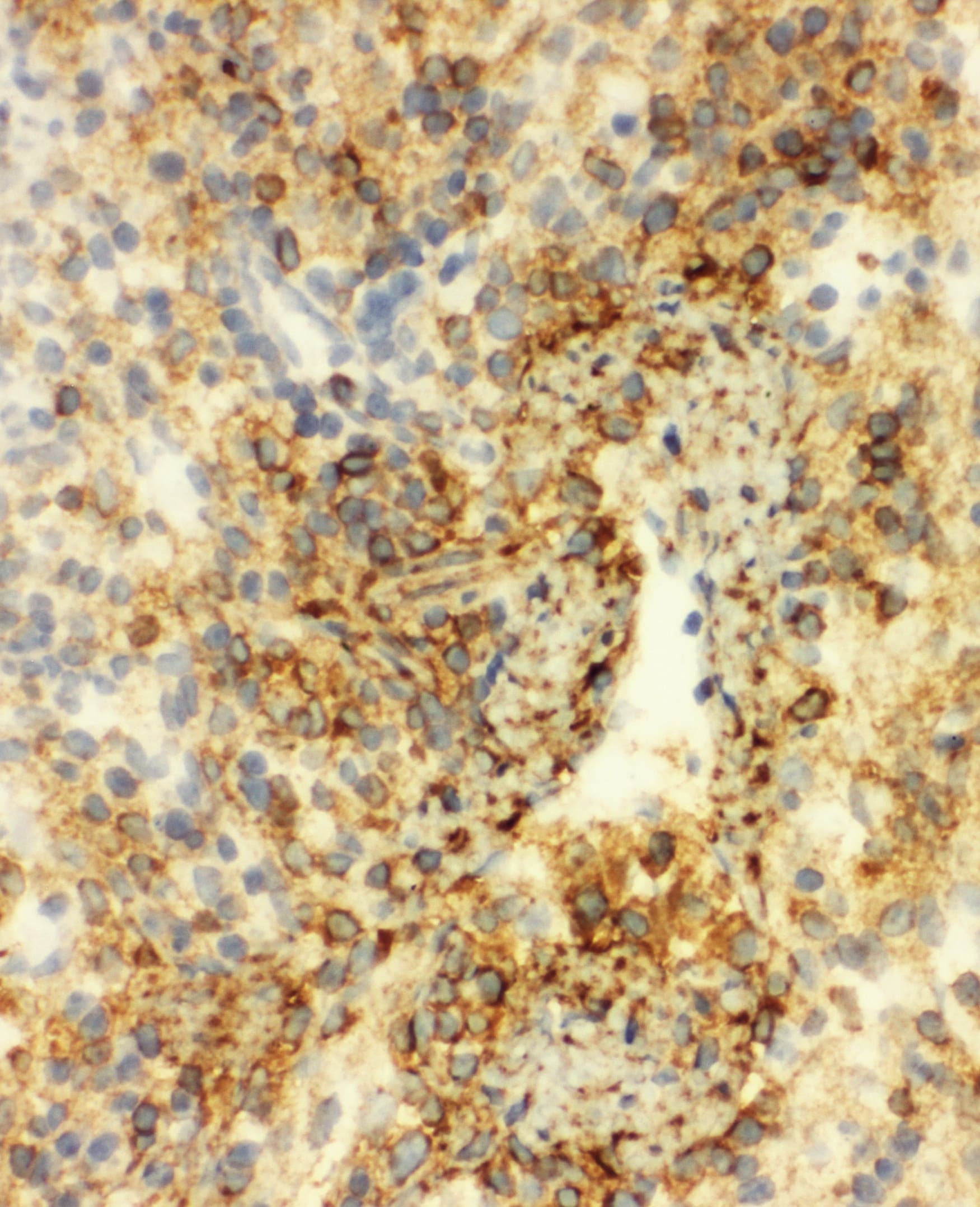 ANXA6/Annexin A6/Annexin VI Antibody (aa636-652)