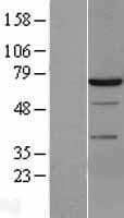SYK Protein (Over-Expression Lysate Myc-DDK (Flag))