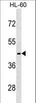 Polyclonal Rabbit anti-Human MC5R / MC5 Receptor Antibody (aa280-308, WB)