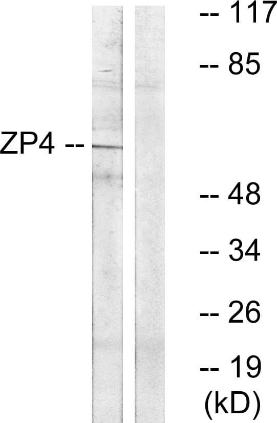 Polyclonal Rabbit anti-Human ZP4 / ZBP Antibody (aa231-280, WB)