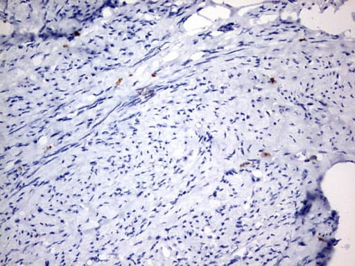 Monoclonal Mouse anti-Human IL20 Antibody (clone 2B1, Carrier-free, aa25-176, IHC, WB)