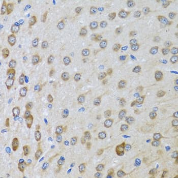 BTD / Biotinidase Antibody