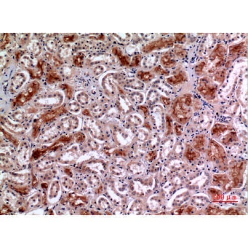 MME / CD10 Antibody (491-540 aa, Internal)