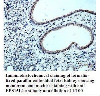 EPS15L1 / EPS15R Antibody (aa327-484)