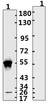 SARS-CoV-2 Nucleoprotein Antibody