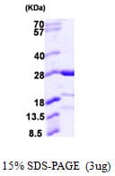 Human CAPSL Protein (Recombinant His)
