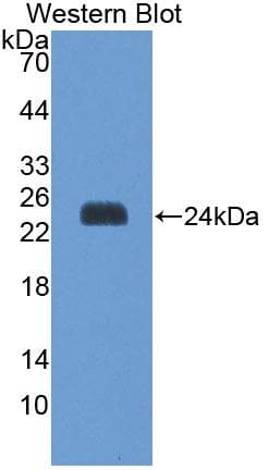 SAT1 / SAT Antibody (aa1-171, PE)