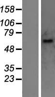 UGT1A10 Protein (Over-Expression Lysate Myc-DDK (Flag))