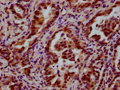 LSM8 / NAA38 Antibody
