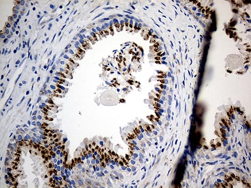 PTPN22 / PEP Antibody (aa359-449, clone OTI6B1)
