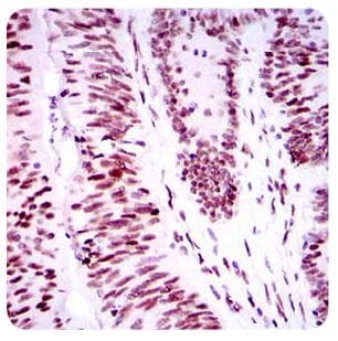 Monoclonal Mouse anti-Human TP53BP1 / 53BP1 Antibody (clone 6B3E10, aa500-800, IHC, WB)