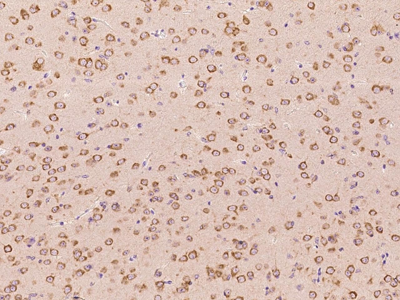 Polyclonal Rabbit anti-Mouse HSPA5 / GRP78 / BiP Antibody (IHC, WB)
