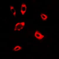 Polyclonal Rabbit anti-Human Dipeptidylpeptidase 8 / DPP8 Antibody (IF, WB)