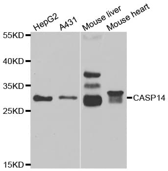 Polyclonal Rabbit anti-Human CASP14 / Caspase 14 Antibody (IHC, IF, WB)