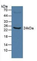 CRP / C-Reactive Protein Antibody (clone C4, Biotin)