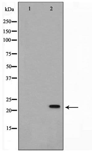 AKAP14 Antibody