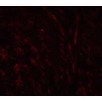 Polyclonal Rabbit anti-Human SPIB Antibody (IHC, IF, WB)
