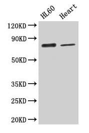 IHC-plus™ CAST / Calpastatin Antibody (aa1-667)
