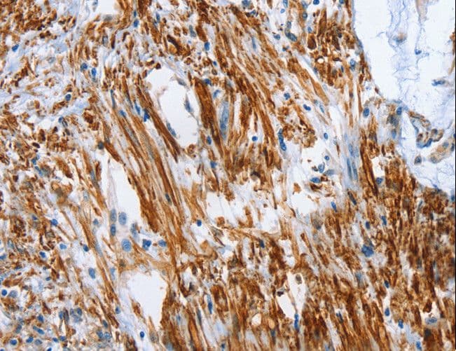 SHROOM2 Antibody