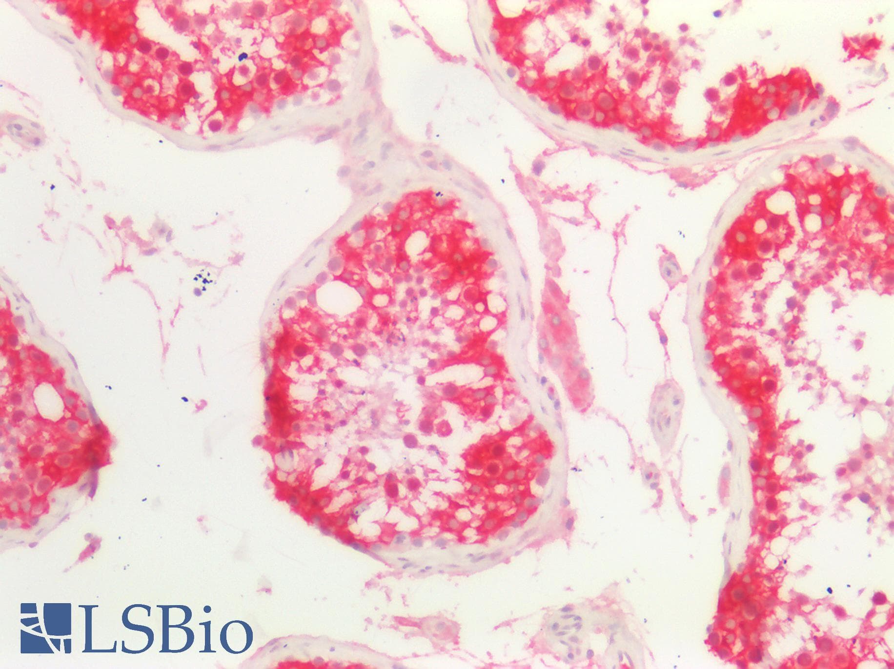 PathPlus™ Osteonectin / SPARC Antibody (clone 2B1)