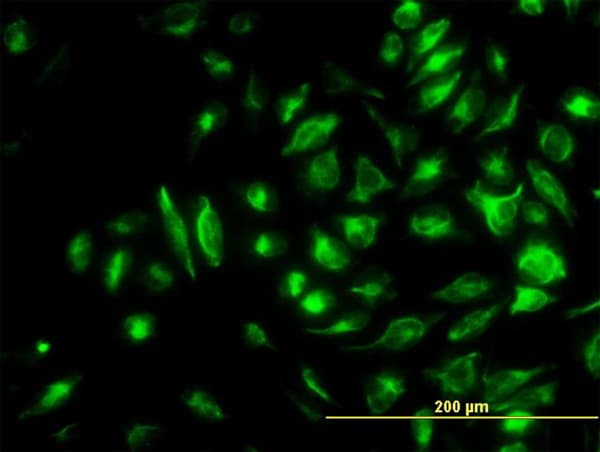 NME2 Antibody (clone 1D3)