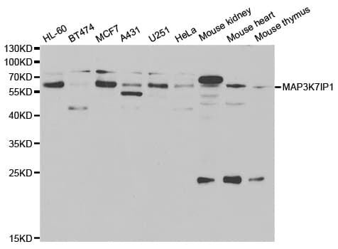Polyclonal Rabbit anti-Human TAB1 Antibody (IHC, IF, WB)