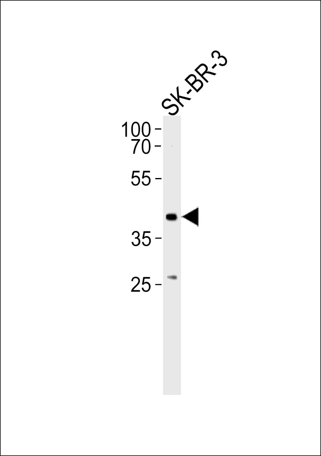 ELK3 / NET Antibody (aa98-126)
