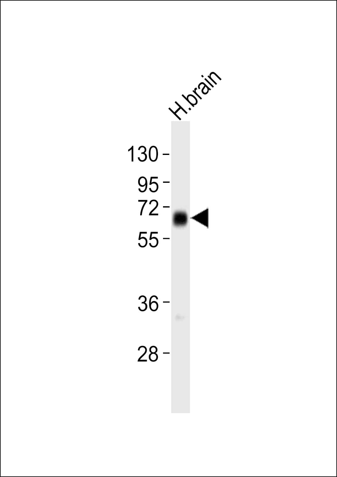 IGSF4C / CADM4 Antibody
