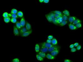 PIM2 / Pim-2 Antibody (clone OTI5D5)