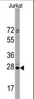 CD9 Antibody (aa21-51)