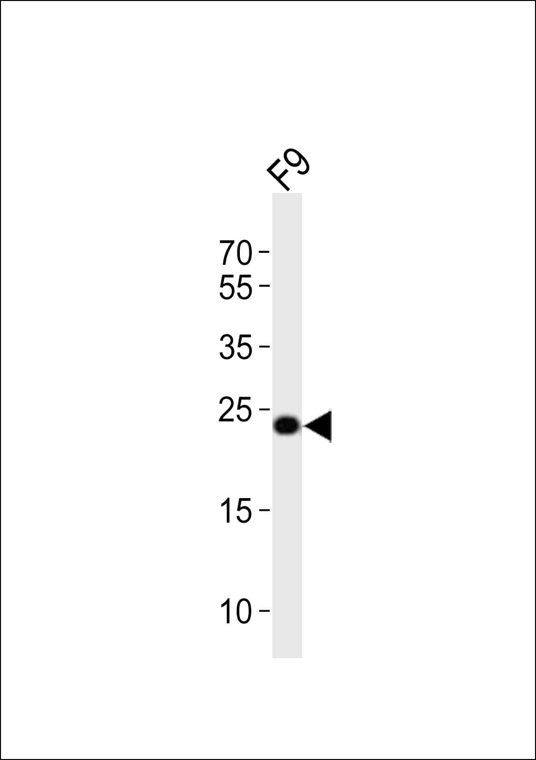 ERAS Antibody (aa19-52)