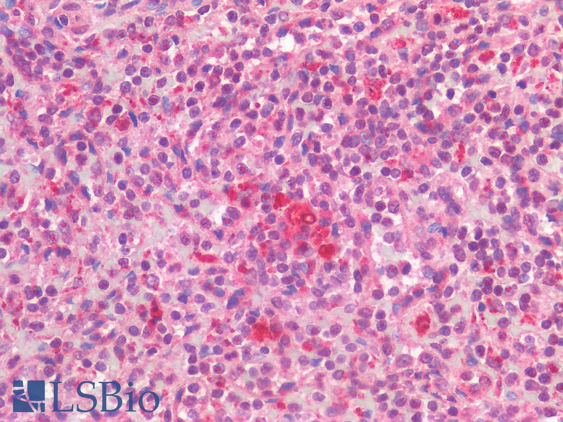 IHC-plus™ Polyclonal Rabbit anti-Human TNFSF4 / OX40L / CD252 Antibody (IHC)