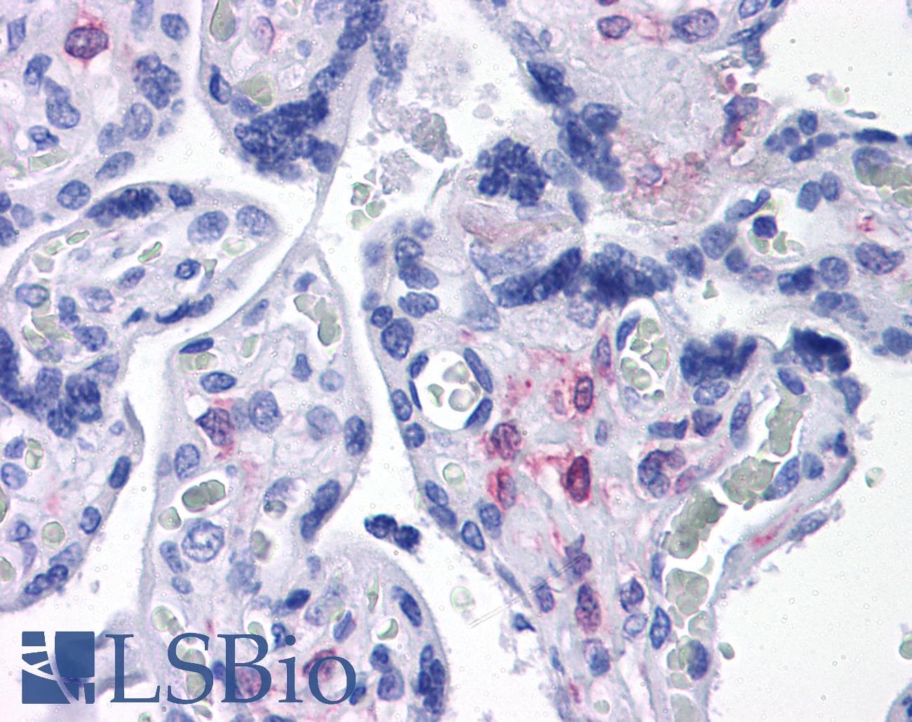 IHC-plus™ PLAC1 Antibody