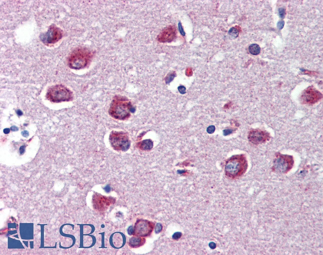 IHC-plus™ Polyclonal Rabbit anti-Human MEF2C Antibody (Ser59, IHC, WB)