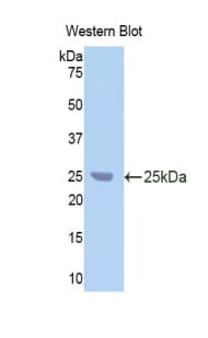CA9 / Carbonic Anhydrase IX Antibody (aa88-280, APC)