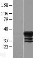 MAGEB4 Protein (Over-Expression Lysate Myc-DDK (Flag))
