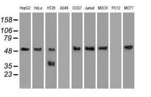 SERPINA1 / Alpha 1 Antitrypsin Antibody (clone 11G2, Carrier-free)