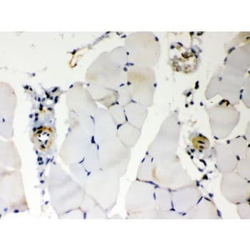 BAK1 / BAK Antibody (aa22-211)